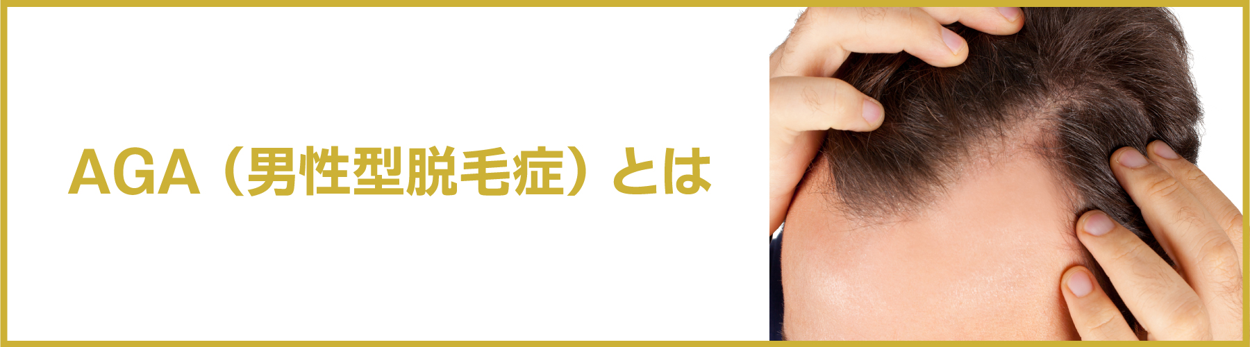 aga治療