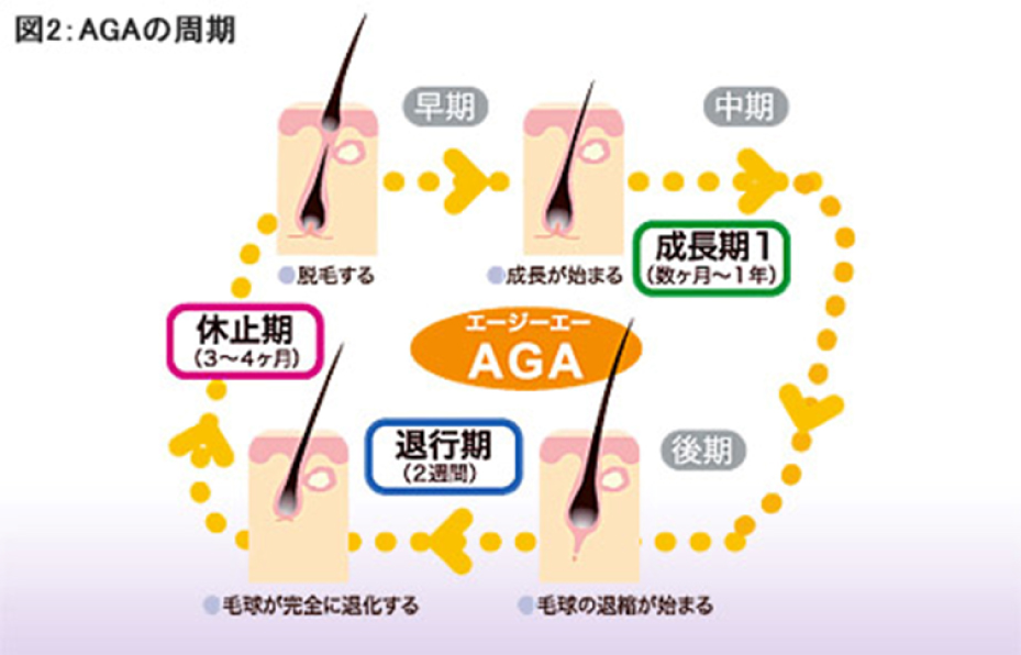 aga治療