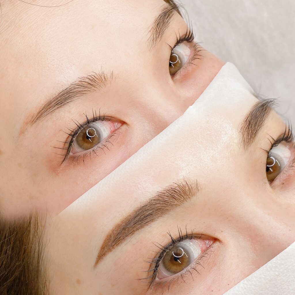 アートメイクの症例写真