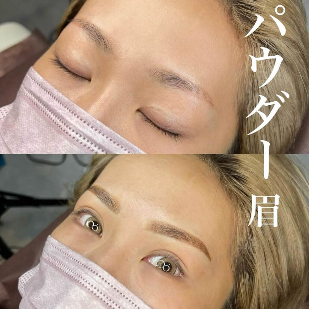 アートメイクの症例写真