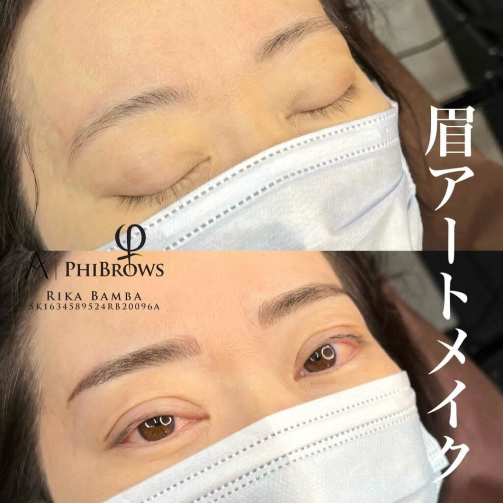 アートメイクの症例写真