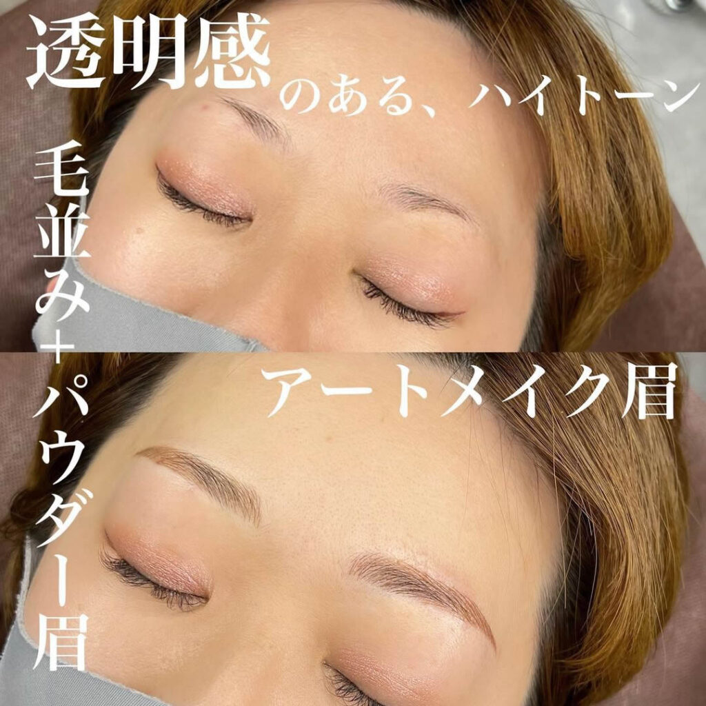 アートメイクの症例写真