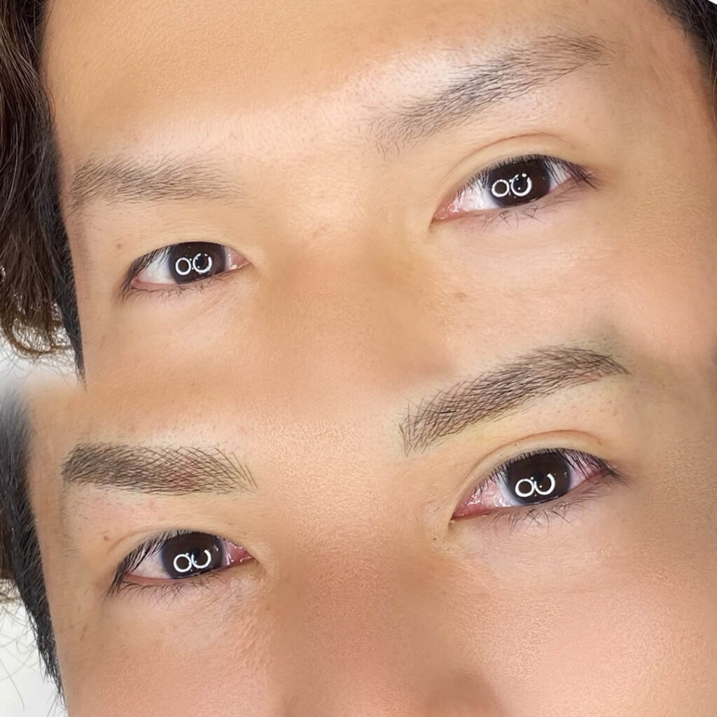 アートメイクの症例写真