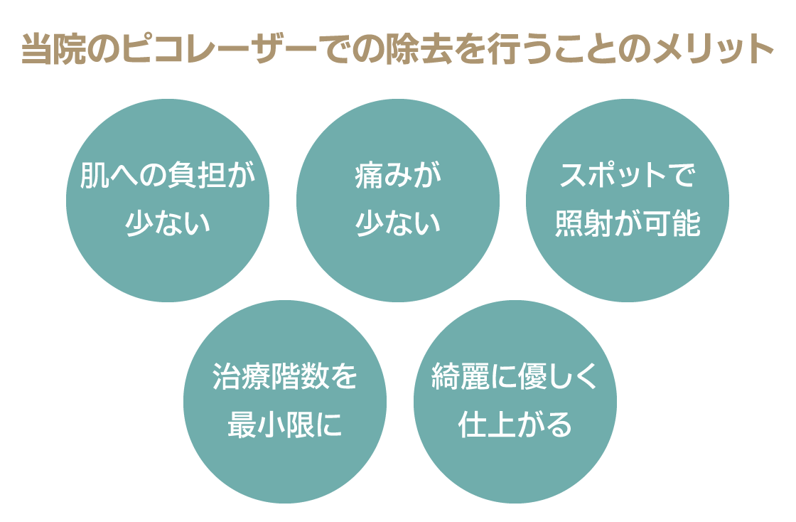 ピコレーザーでのタトゥー除去を行うメリット